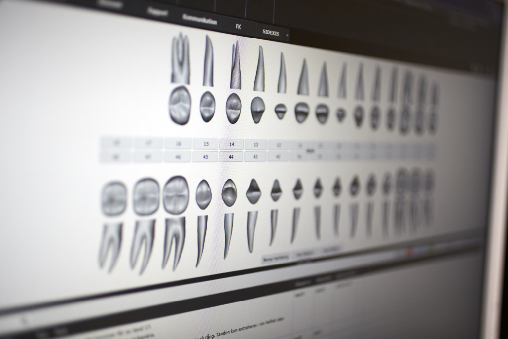 Tänder i en röntgenbild på en dataskärm under en tandundersökning.
