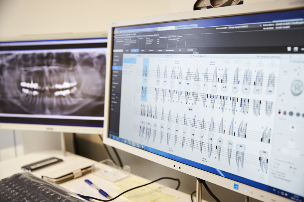 Dataskärm som visar rontgen av tänder och kartäggning inför behandling.